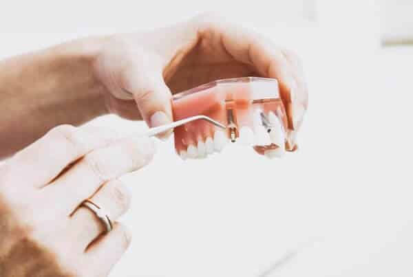 Dental Implants liss geotagged