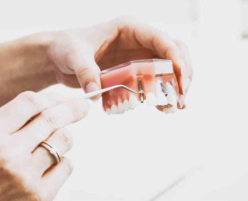 Dental Implants liss geotagged