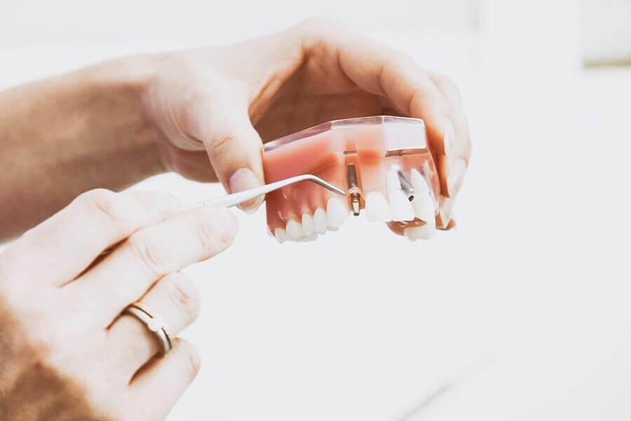 Dental Implants liss geotagged